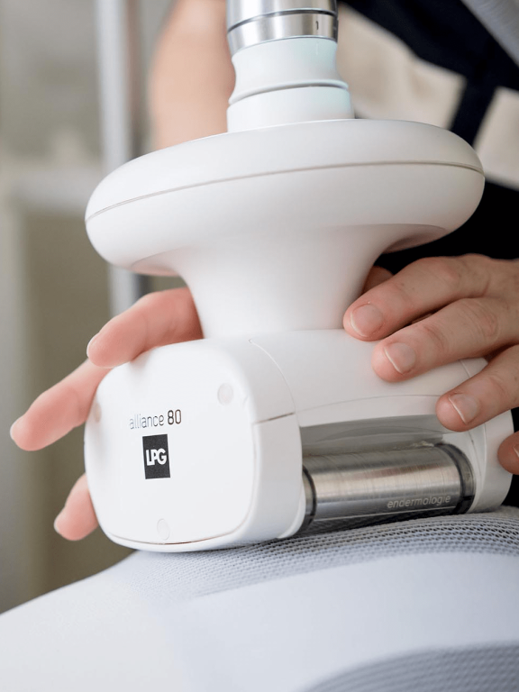 appareil lpg en marche